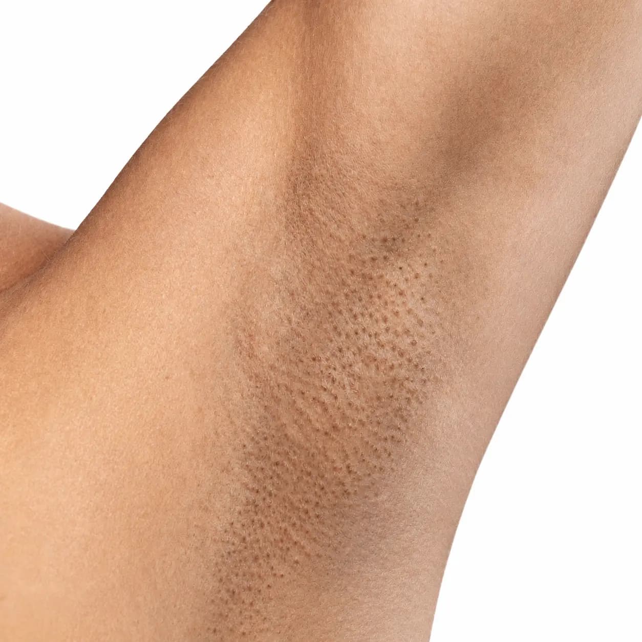 Skin before Liquid Black Soap ritual