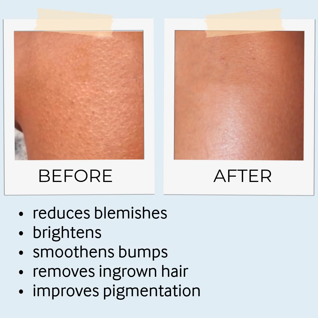 Tebrima Body Mask - Image 9