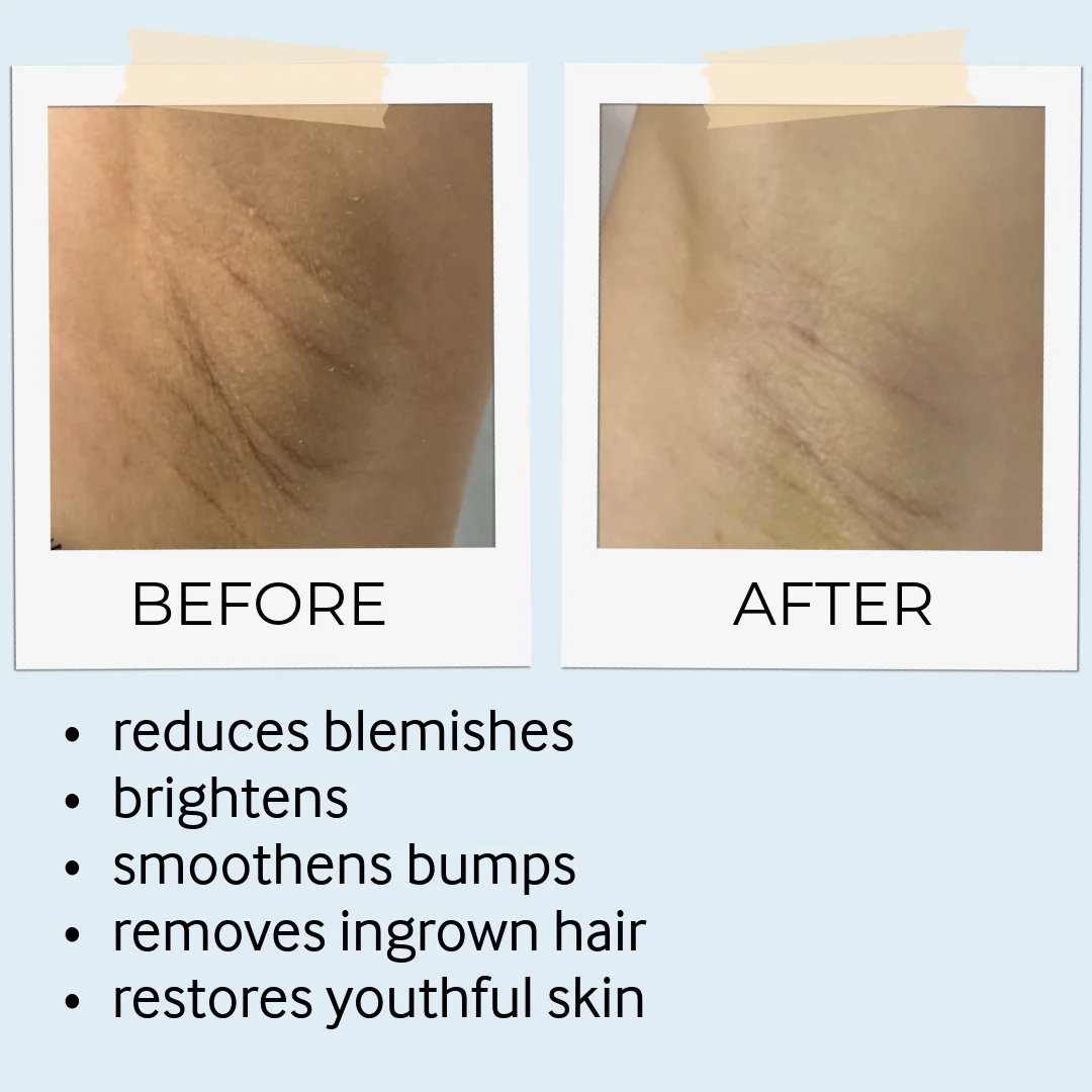 Tebrima Body Mask - Image 8