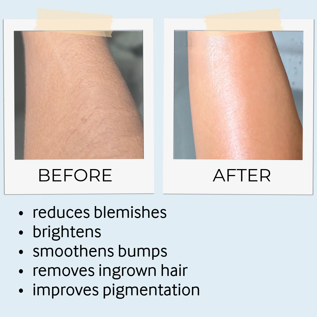 Tebrima Body Mask - Image 6